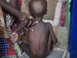 Child Nutrition: Why Nigeria must not rank lowest in Africa